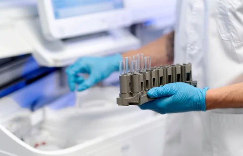 sample-collection-and-processing