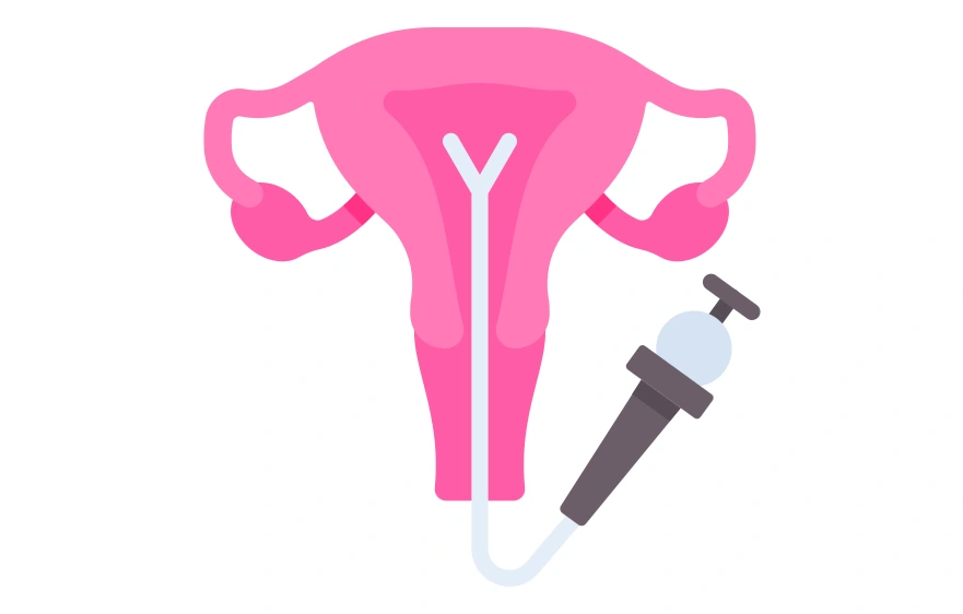 Hysteroscopy