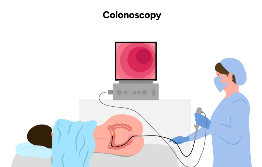 colonoscopy-banner4.webp