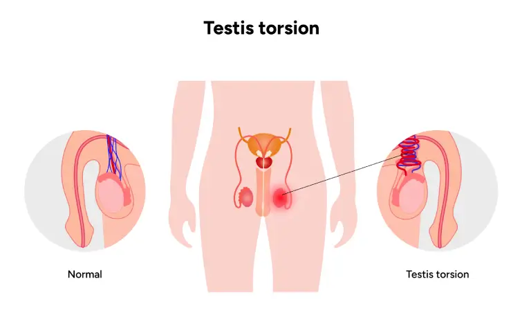 testicular-banner.webp