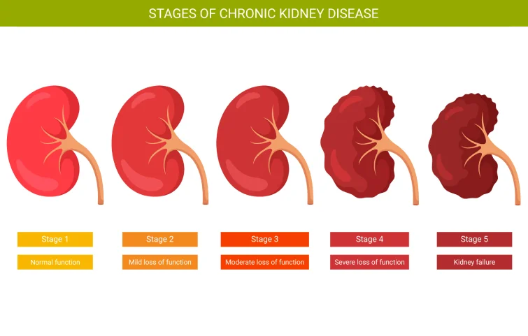 chronic-kidney-disease-banner2.webp