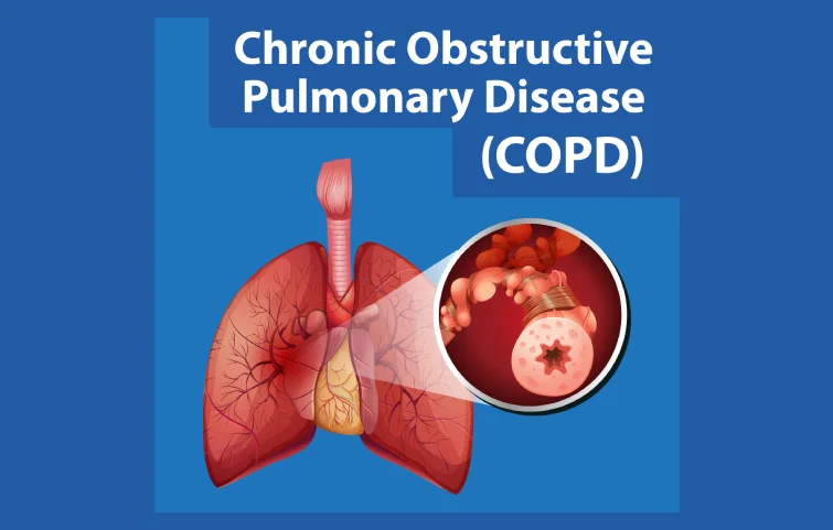 copd-banner.webp