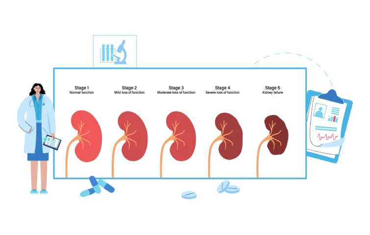 accute-kidney-injury-banner5.webp