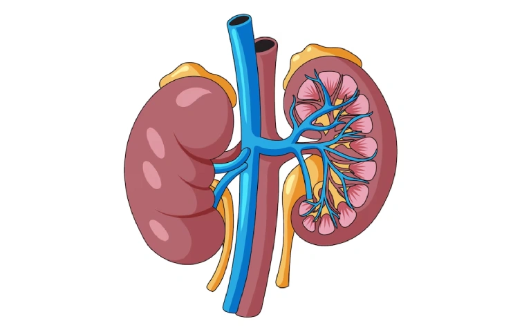 Acute Renal2.webp
