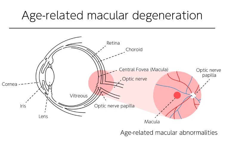 New Project (11).webp