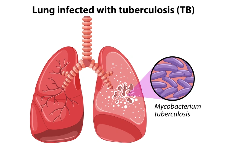 slider-image' (2) (1).webp