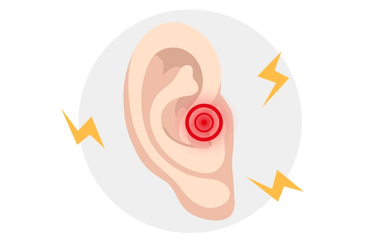 slider-image' (2) (2).webp