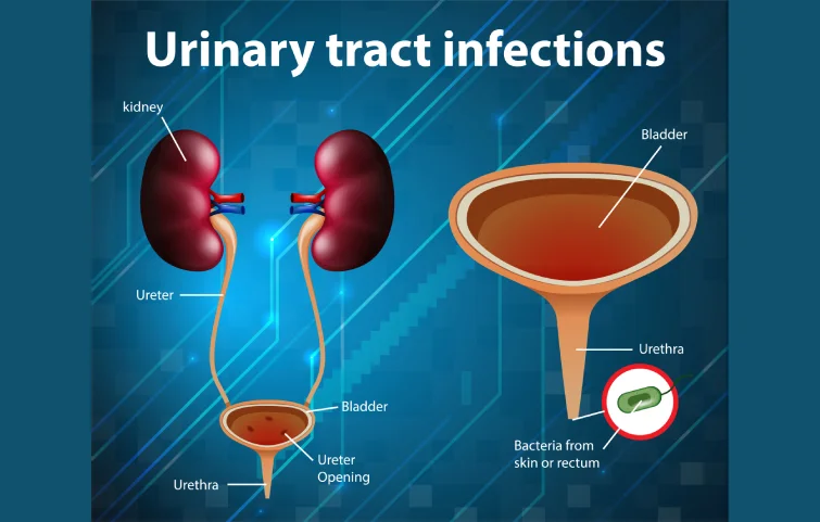 23asi_urinary-tract-banner.webp