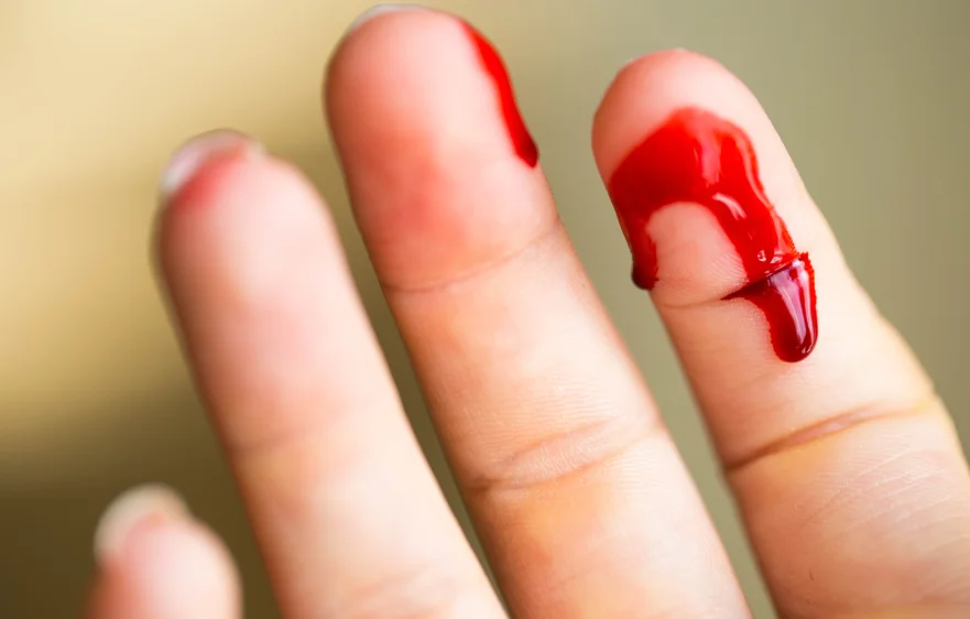 bleeding-disorder-banner (3).webp