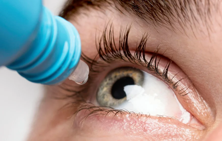 blephatitis-banner (3).webp