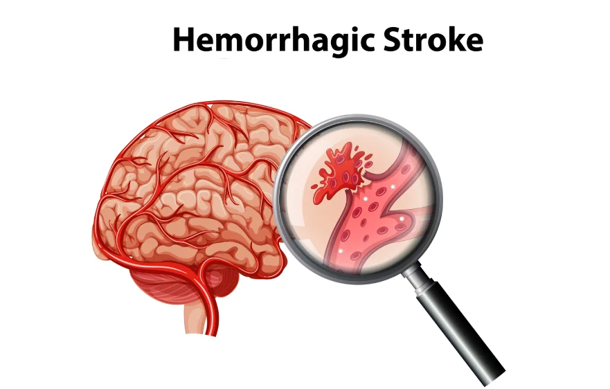 brain-hammriage-banner (4).webp