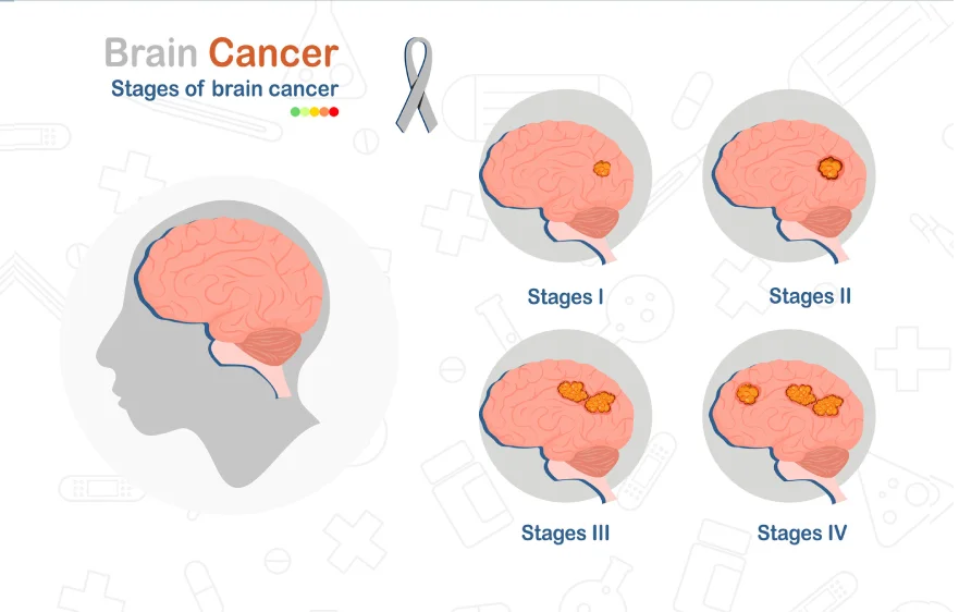 brain-tumor-banner.webp