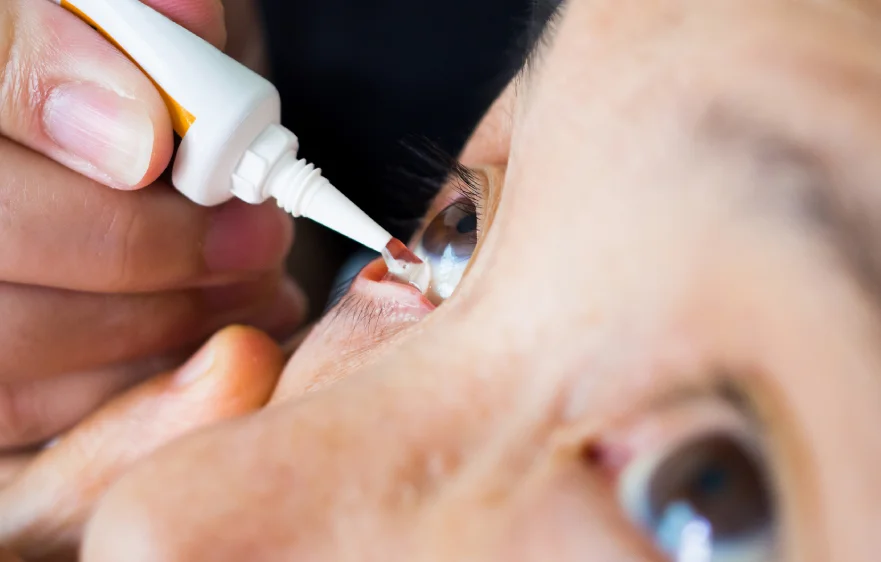 dry-eyes-banner (1).webp