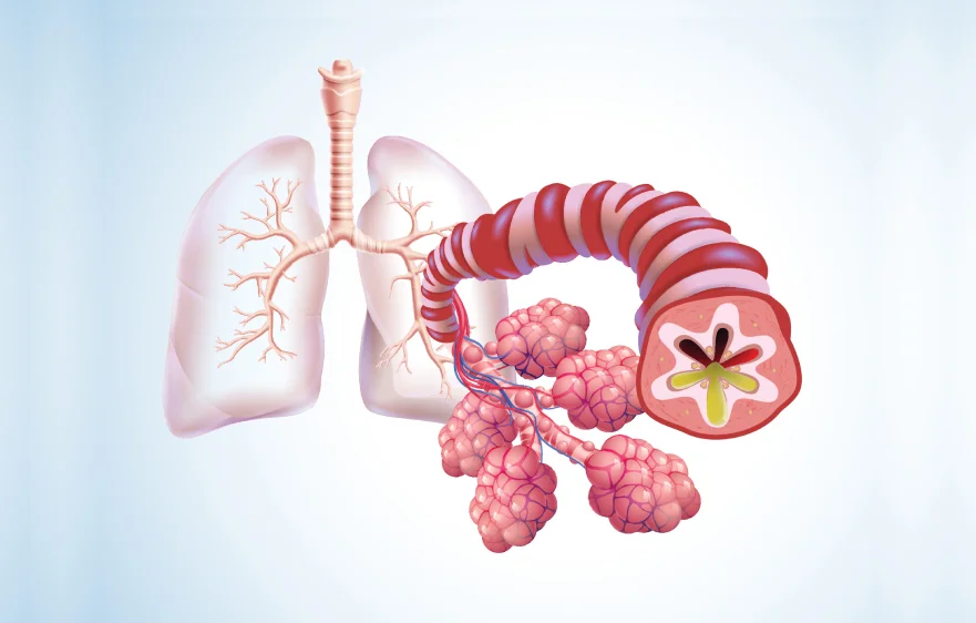 bronchitis-banner.webp