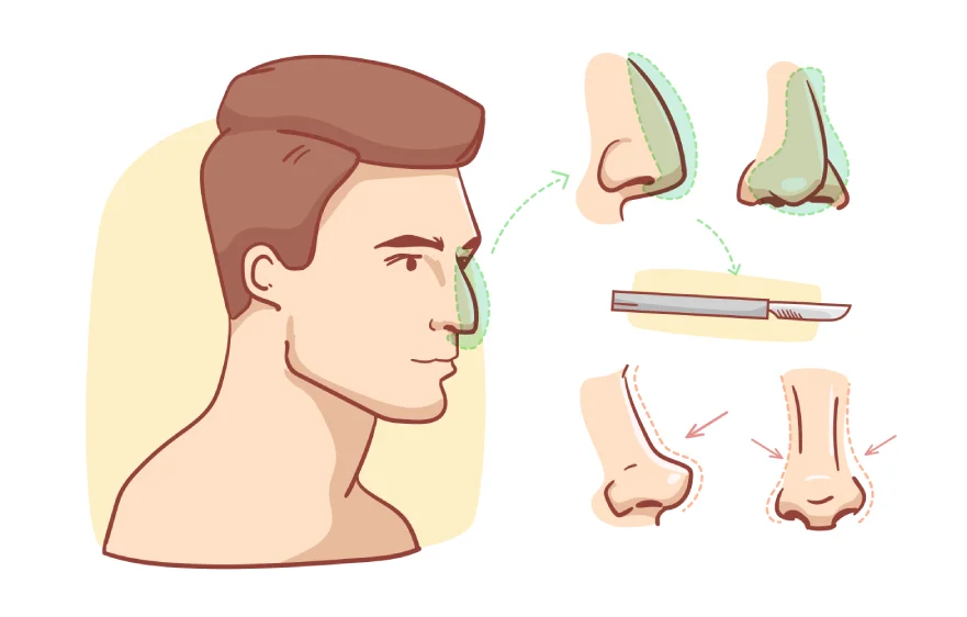 ear-nose-banner (1).webp