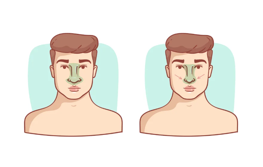 ear-nose-banner (2).webp