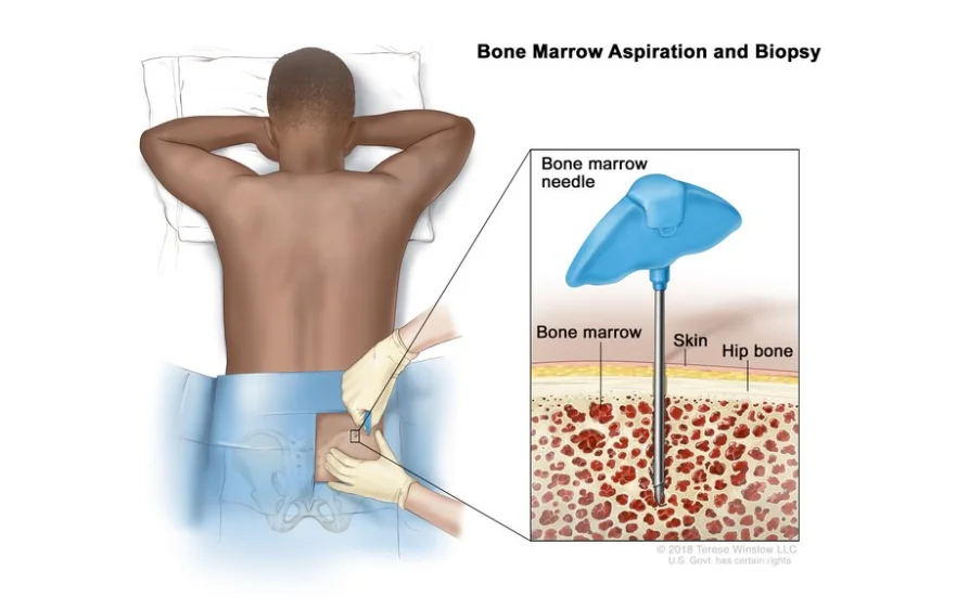 bone-marrow-banner.webp