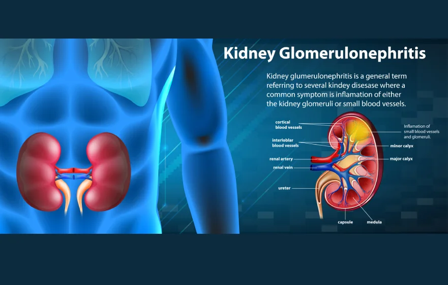 kidney-banner.webp