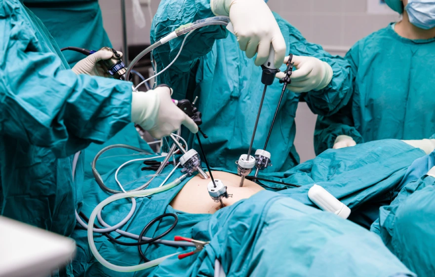 overview-laparoscopic-cholecystectomy (1).webp