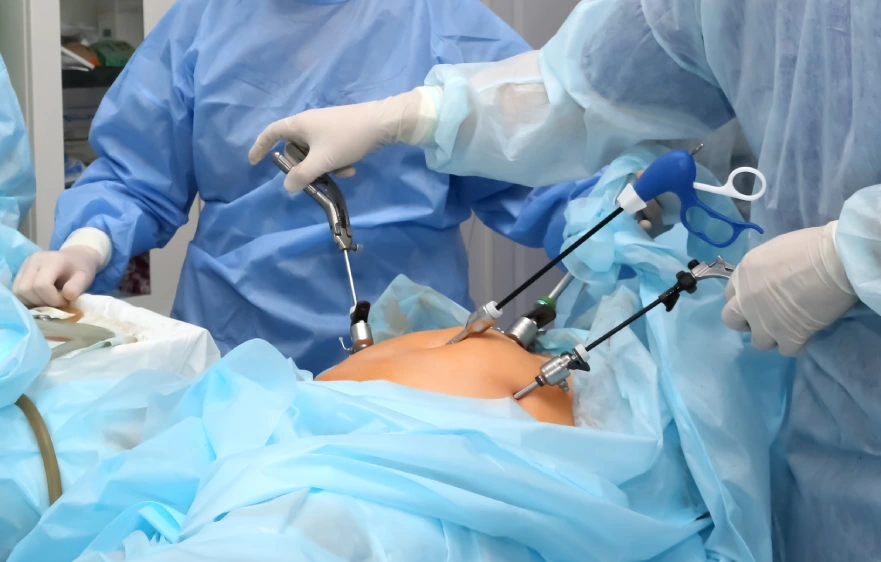 overview-laparoscopic-cholecystectomy.webp