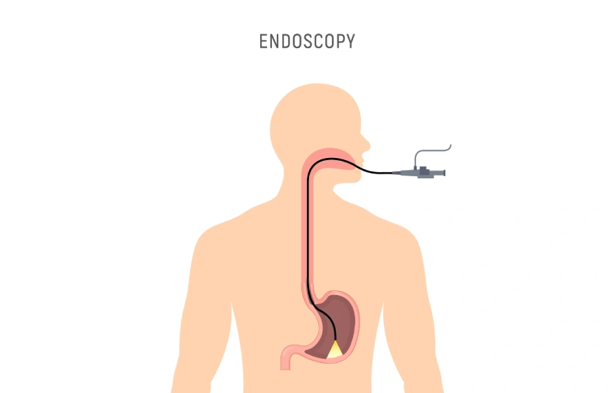 New Project (3).webp