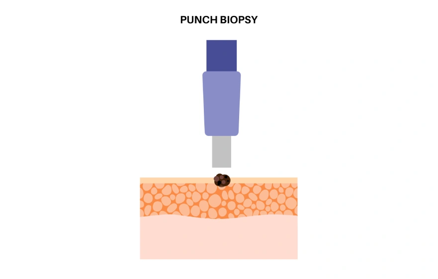 New Project (6).webp