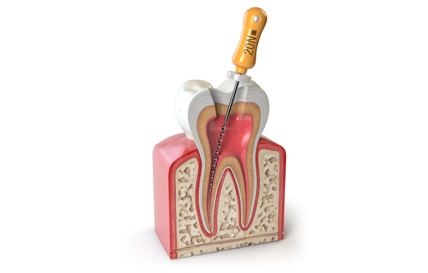 New Project (7).webp