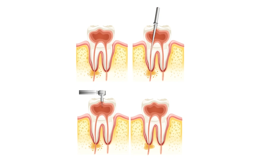 New Project (8).webp