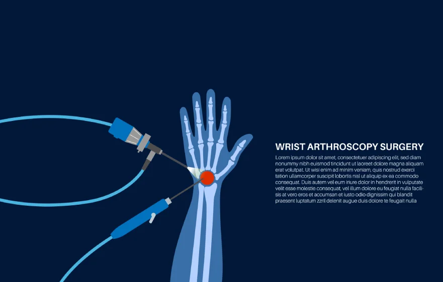 arthroscopy-banner (2) (1).webp