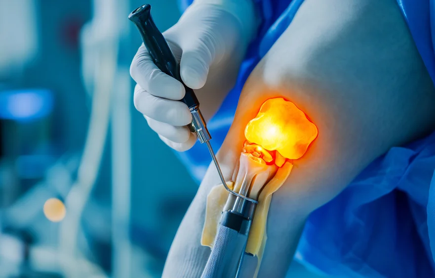 arthroscopy-banner2 (2).webp