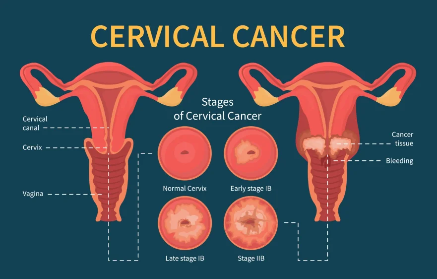 cervical-banner (1).webp