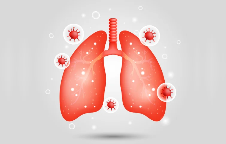 acute-respiratory-banner.webp