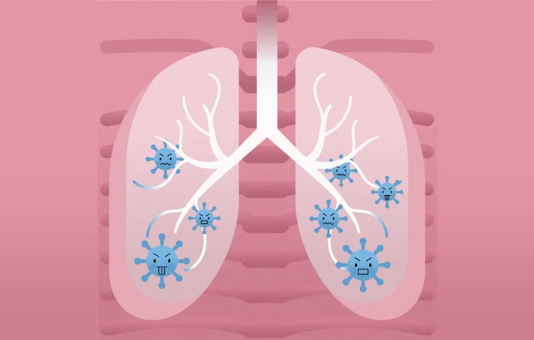 acute-respiratory-banner3 (1).webp
