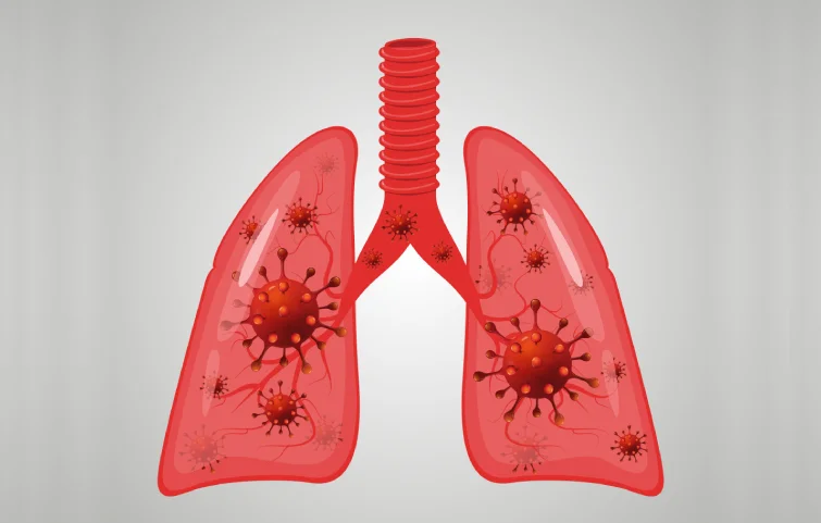 acute-respiratory-banner3.webp