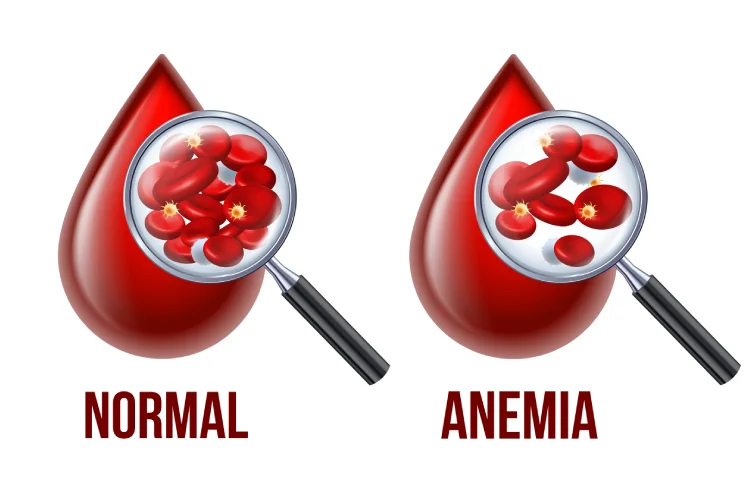 anemia-banner4.webp