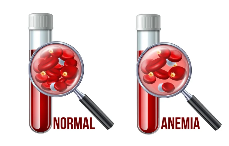 anemia-banner5.webp