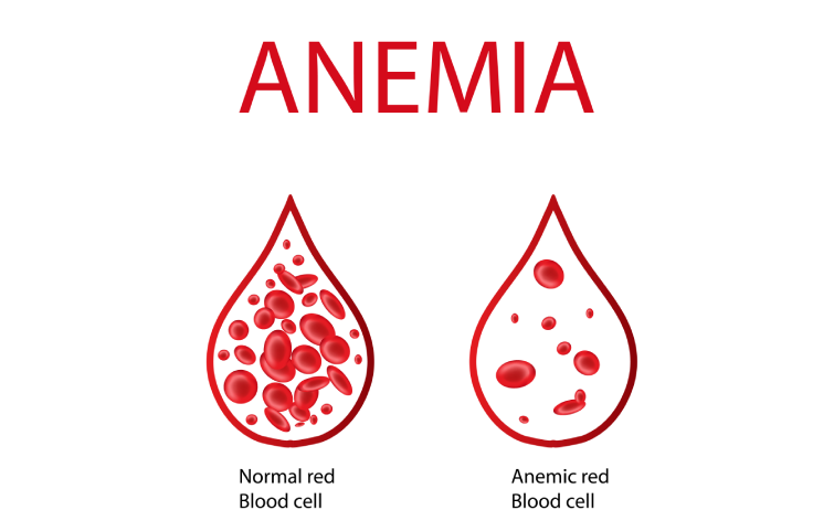 anemia-bannernew3.webp