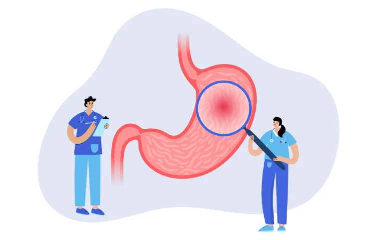 peptic-ulcer-banner5.webp